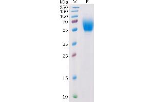 Human IL13RA1  Protein, His Tag on SDS-PAGE under reducing condition. (IL13 Receptor alpha 1 Protein (AA 23-343) (His tag))