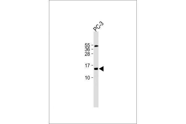 FUNDC2 anticorps  (C-Term)