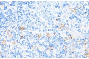 Immunohistochemistry of paraffin-embedded Rat spleen using CD11A Polyclonal Antibody at dilution of 1:100 (40x lens). (ITGAL anticorps)