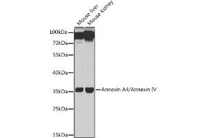 Western blot analysis of extracts of various cell lines, using Annexin /Annexin IV antibody (ABIN6127353, ABIN6136931, ABIN6136933 and ABIN6217476) at 1:1000 dilution. (Annexin IV anticorps  (AA 112-321))