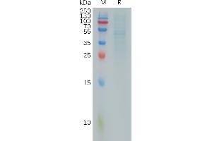 Human RHOC Protein, hFc Tag on SDS-PAGE under reducing condition. (RHOC Protein (AA 1-190) (Fc Tag))