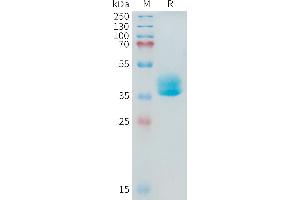 Human A(581-642) Protein, mFc Tag on SDS-PAGE under reducing condition. (ADAM17 Protein (AA 581-642) (mFc Tag))