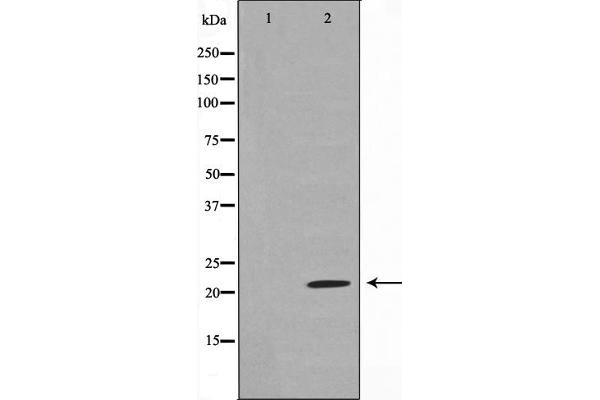 SDC4 anticorps  (C-Term)