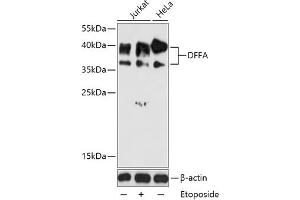 Western blot analysis of extracts of various cell lines, using DFFA antibody (ABIN6127756, ABIN6139549, ABIN6139551 and ABIN6216052) at 1:1000 dilution. (DFFA anticorps  (AA 1-331))