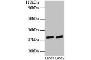 Western blot All lanes: GATD3A antibody at 2 μg/mL Lane 1: EC109 whole cell lysate Lane 2: 293T whole cell lysate Secondary Goat polyclonal to rabbit IgG at 1/15000 dilution Predicted band size: 29, 25 kDa Observed band size: 29 kDa (GATD3A (AA 43-268) anticorps)