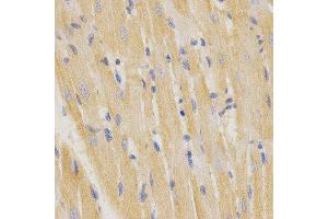 Immunohistochemistry (IHC) image for anti-Surfactant Protein C (SFTPC) antibody (ABIN1874760) (Surfactant Protein C anticorps)