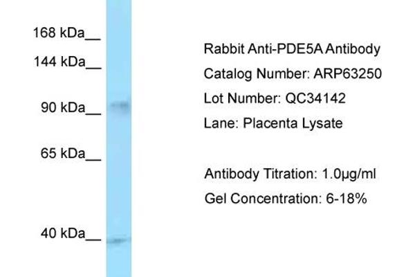 PDE5A anticorps  (C-Term)