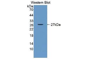 Western blot analysis of the recombinant protein. (ITPA anticorps  (AA 3-180))