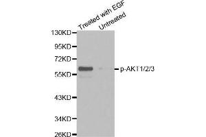 Western blot analysis of extracts from HepG2 cells untreated or treated with EGF using Phospho-AKT1/2/3-Y315/316/312 antibody (AKT 1/2/3 anticorps  (pTyr312))