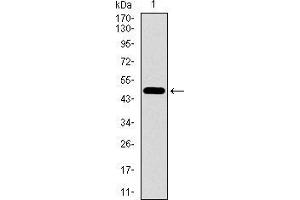 Western Blotting (WB) image for anti-EGFR Mutant (AA 693-893) antibody (ABIN1724824)