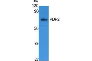 Western Blotting (WB) image for anti-Pyruvate Dehyrogenase Phosphatase Catalytic Subunit 2 (PDP2) (Internal Region) antibody (ABIN3178105) (PDP2 anticorps  (Internal Region))
