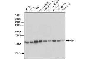 Western blot analysis of extracts of various cell lines, using RPS19 Rabbit mAb (ABIN1681275, ABIN3017969, ABIN3017970 and ABIN7101552) at 1:1000 dilution. (RPS19 anticorps)