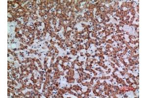 Immunohistochemical analysis of paraffin-embedded human-liver, antibody was diluted at 1:100. (APAF1 anticorps  (Internal Region))