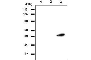 Western Blotting (WB) image for anti-Ras Association (RalGDS/AF-6) Domain Family Member 1 (RASSF1) antibody (ABIN165456) (RASSF1 anticorps)