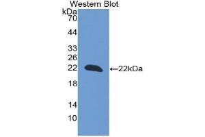 Detection of Recombinant PARK7, Rat using Monoclonal Antibody to Parkinson Disease Protein 7 (PARK7) (PARK7/DJ1 anticorps  (AA 1-189))