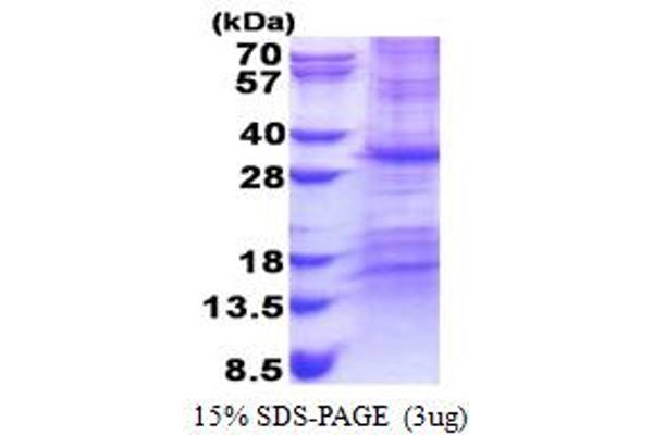 CHCHD3 Protein (AA 1-227) (His tag)