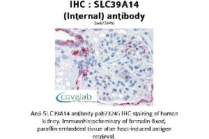 Image no. 1 for anti-Solute Carrier Family 39 (Zinc Transporter), Member 14 (SLC39A14) (Internal Region) antibody (ABIN1739370) (SLC39A14 anticorps  (Internal Region))