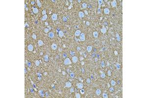 Immunohistochemistry of paraffin-embedded mouse brain using STX1A antibody (ABIN6134937, ABIN6148660, ABIN6148662 and ABIN6223930) (40x lens). (STX1A anticorps)