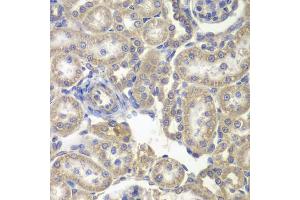 Immunohistochemistry of paraffin-embedded rat kidney using H6PD antibody (ABIN5973840) at dilution of 1/200 (40x lens). (Glucose-6-Phosphate Dehydrogenase anticorps)