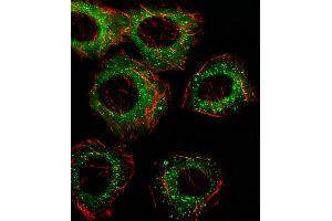 Fluorescent image of A549 cell stained with FADS2 Antibody (N-term). (FADS2 anticorps  (N-Term))