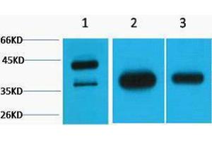 Western Blotting (WB) image for anti-Growth Associated Protein 43 (GAP43) antibody (ABIN3181291) (GAP43 anticorps)