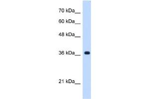 C19ORF47 antibody used at 0. (C19orf47 anticorps  (C-Term))