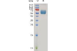 Human TG Protein, hFc Tag on SDS-PAGE under reducing condition. (TGFBR2 Protein (AA 23-159) (Fc Tag))