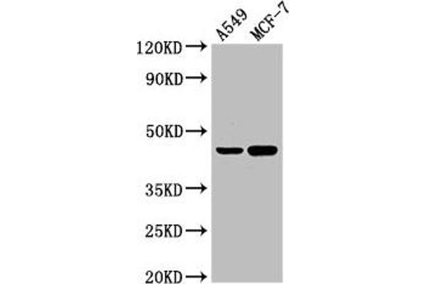 AGXT anticorps  (AA 112-294)