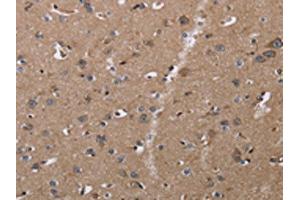 The image on the left is immunohistochemistry of paraffin-embedded Human brain tissue using ABIN7128954(CLDN23 Antibody) at dilution 1/30, on the right is treated with fusion protein. (Claudin 23 anticorps)