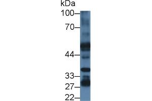 Detection of PSR in Mouse Liver lysate using Polyclonal Antibody to Phosphatidylserine Receptor (PSR) (JMJD6 anticorps  (AA 1-334))