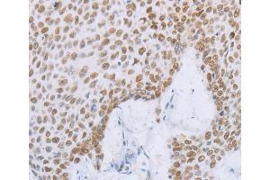 Immunohistochemistry (IHC) image for anti-Minichromosome Maintenance Complex Component 2 (MCM2) antibody (ABIN2428399) (MCM2 anticorps)