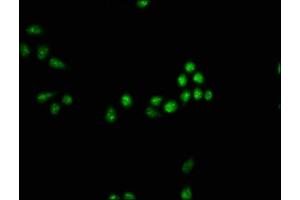 Immunofluorescence staining of Hela cells with ABIN7160246 at 1:33, counter-stained with DAPI. (SMAD7 anticorps  (AA 36-247))