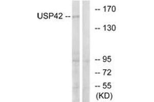 Western blot analysis of extracts from HT-29 cells, using USP42 Antibody. (USP42 anticorps  (AA 251-300))