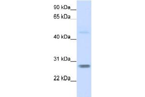 WB Suggested Anti-FBXO25  Antibody Titration: 0. (FBXO25 anticorps  (N-Term))