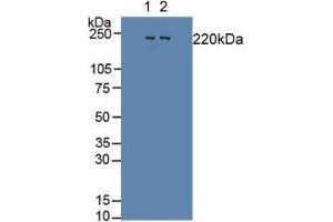 Western blot analysis of (1) Rat Brain Tissue and (2) Mouse Brain Tissue. (SLIT1 anticorps  (AA 308-512))