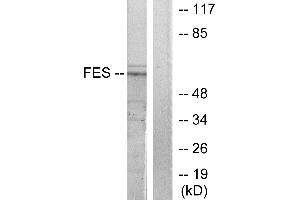 Western blot analysis of extracts from HUVEC cells, treated with serum (20%, 30mins), using FES antibody. (FES anticorps  (Internal Region))