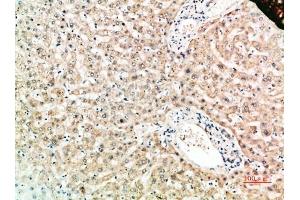 Immunohistochemical analysis of paraffin-embedded human-liver, antibody was diluted at 1:200. (TNFRSF11A anticorps  (AA 60-120))