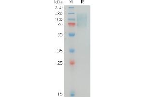 Human MERTK Protein, His Tag on SDS-PAGE under reducing condition. (MERTK Protein (AA 21-505) (His tag))