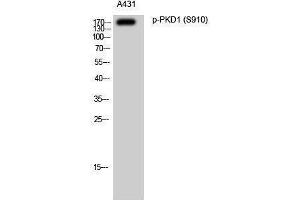Western Blotting (WB) image for anti-Polycystic Kidney Disease 1 (Autosomal Dominant) (PKD1) (pSer910) antibody (ABIN3173025) (PKD1 anticorps  (pSer910))