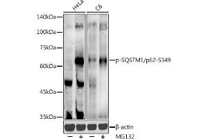 Western blot analysis of extracts of various cell lines, using Phospho-SQSTM1/p62-S349 antibody (ABIN7270206) at 1:500 dilution. (SQSTM1 anticorps  (pSer349))
