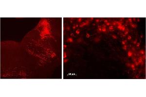 Immunohistochemistry (0. (Tryptophan Hydroxylase 2 anticorps  (Internal Region))