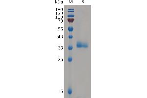 Human IG Protein, His Tag on SDS-PAGE under reducing condition. (IGFBP7 Protein (AA 30-282) (His tag))