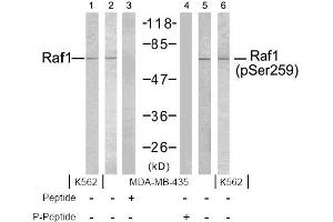 Image no. 2 for anti-V-Raf-1 Murine Leukemia Viral Oncogene Homolog 1 (RAF1) (pSer259) antibody (ABIN196619) (RAF1 anticorps  (pSer259))