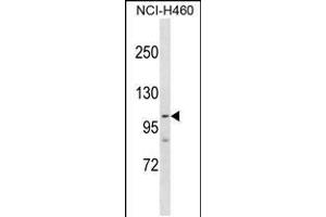 Western blot analysis in NCI-H460 cell line lysates (35ug/lane). (PARP1 anticorps  (AA 590-618))