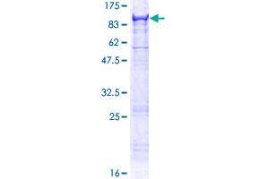 Image no. 1 for Mannan-Binding Lectin serine Peptidase 2 (MASP2) (AA 1-686) protein (GST tag) (ABIN1310416) (MASP2 Protein (AA 1-686) (GST tag))