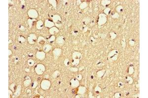 Immunohistochemistry of paraffin-embedded human brain tissue using ABIN7166372 at dilution of 1:100 (ZNF365 anticorps  (AA 241-401))