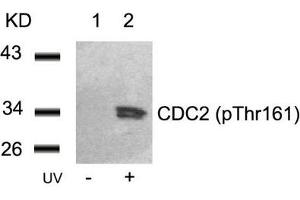 Western blot analysis of extracts from Hela cells untreated(lane 1) or treated with UV(lane 2) using CDC2(Phospho-Thr161) Antibody. (CDK1 anticorps  (pThr161))