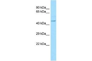 WB Suggested Anti-NLE1 Antibody Titration: 1. (NLE1 anticorps  (C-Term))