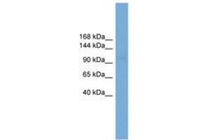 Image no. 1 for anti-Solute Carrier Family 9 (Sodium/hydrogen Exchanger), Member 3 (SLC9A3) (AA 611-660) antibody (ABIN6745597) (SLC9A3 anticorps  (AA 611-660))