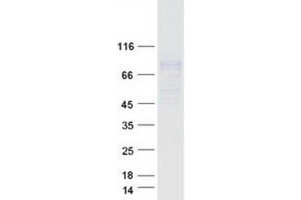 FCRL2 Protein (Transcript Variant 2) (Myc-DYKDDDDK Tag)